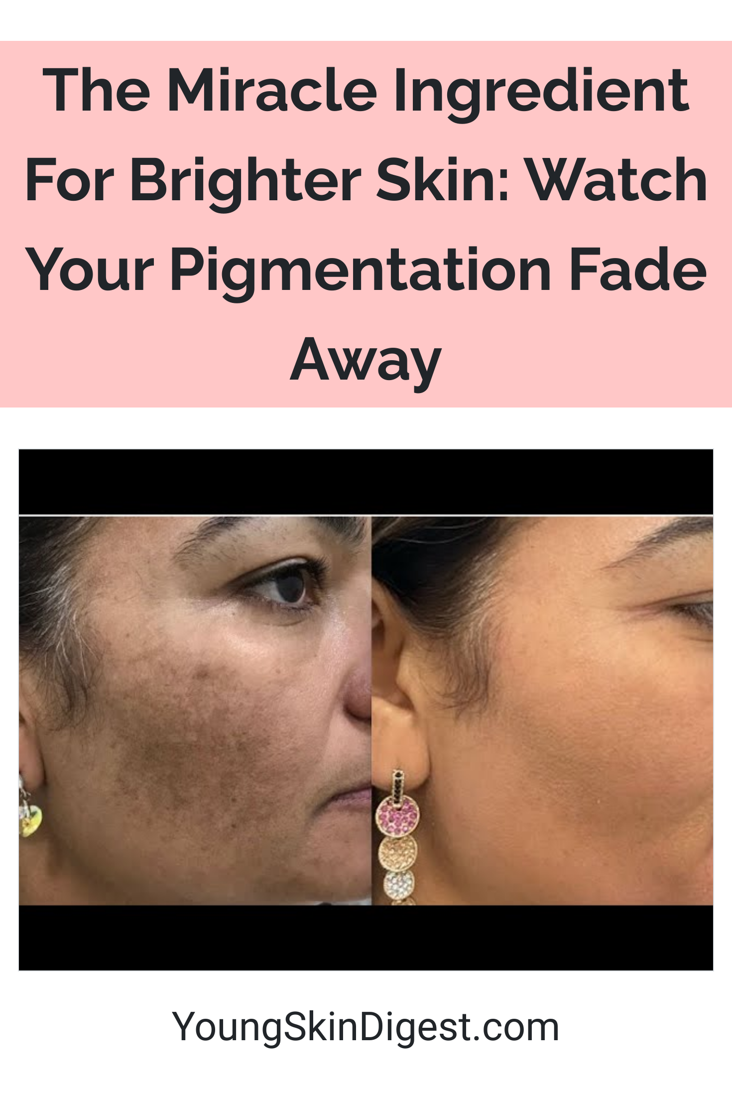 The Miracle Ingredient For Brighter Skin Watch Your Pigmentation Fade