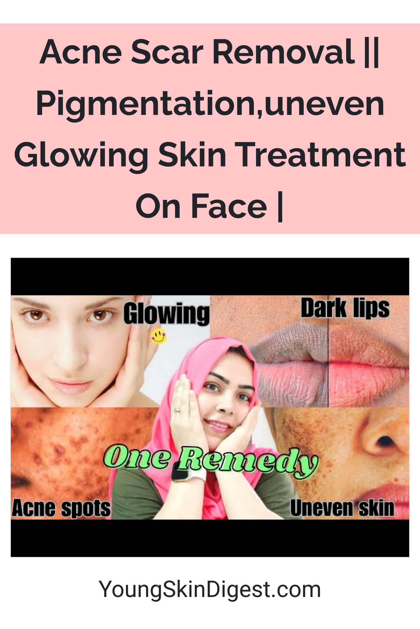 Acne Scar Removal || Pigmentation,uneven Glowing Skin Treatment On Face ...