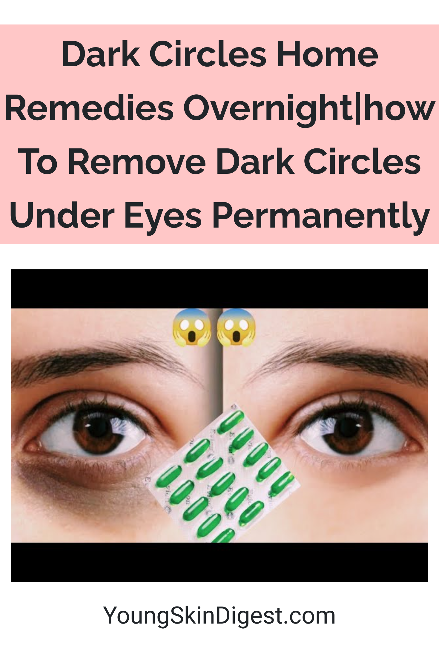 Dark Circles Home Remedies Overnight How To Remove Dark Circles Under